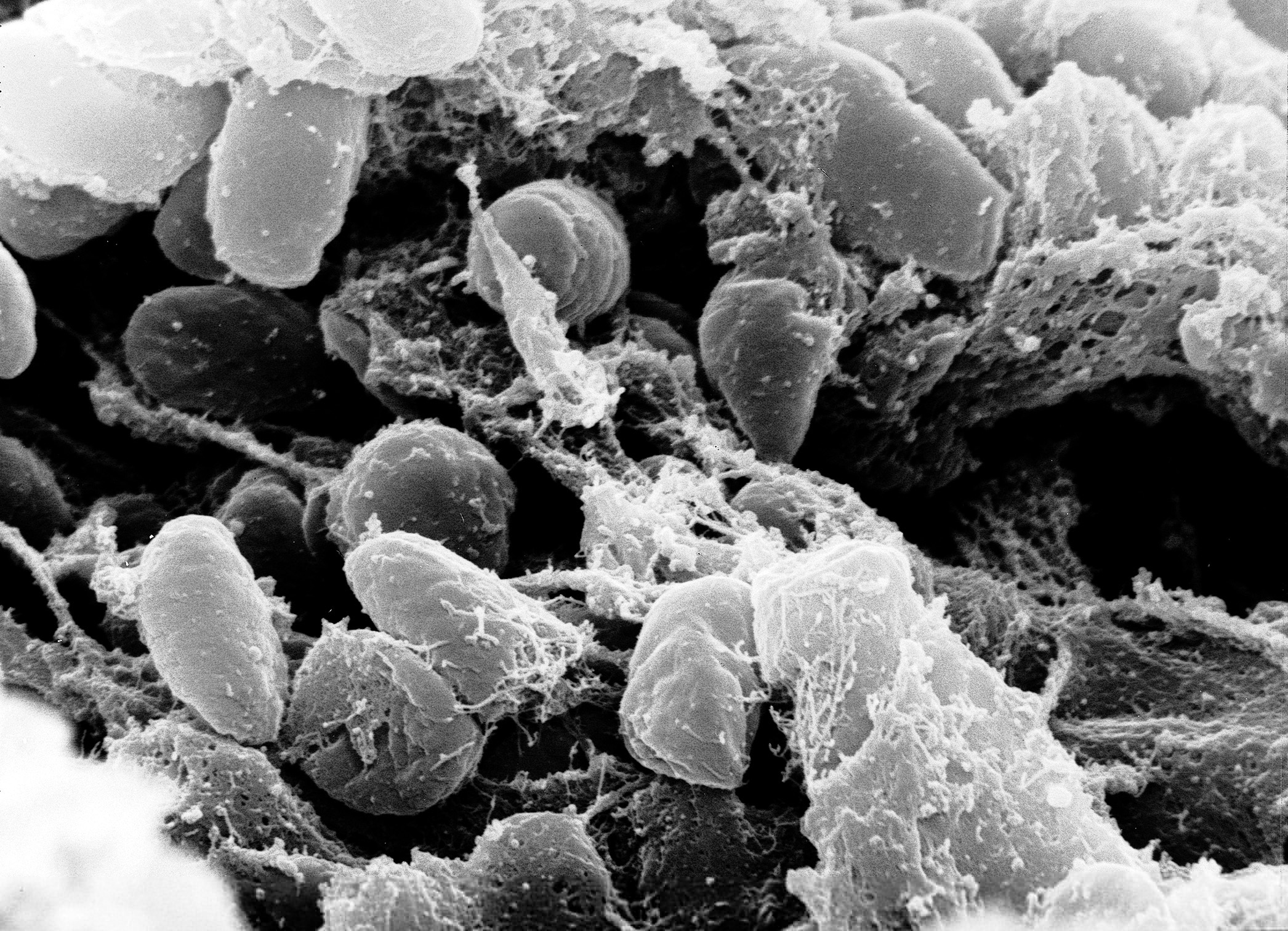Micrografía de archivo de Yersinia pestis